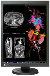 eizo_radiforce_mx215_2