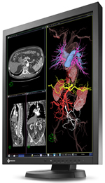 eizo_radiforce_mx215_1